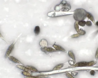 Microscopic image published by SmartSoil